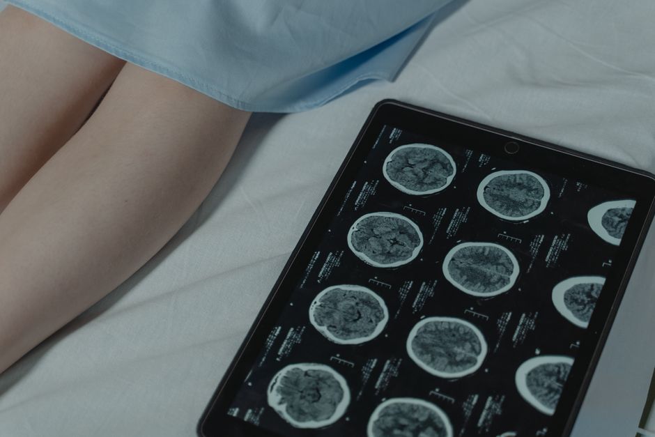 The Rise of Web-Native Bioinformatics: How Platforms Like ITHindex Are Reshaping Cancer Research Tooling