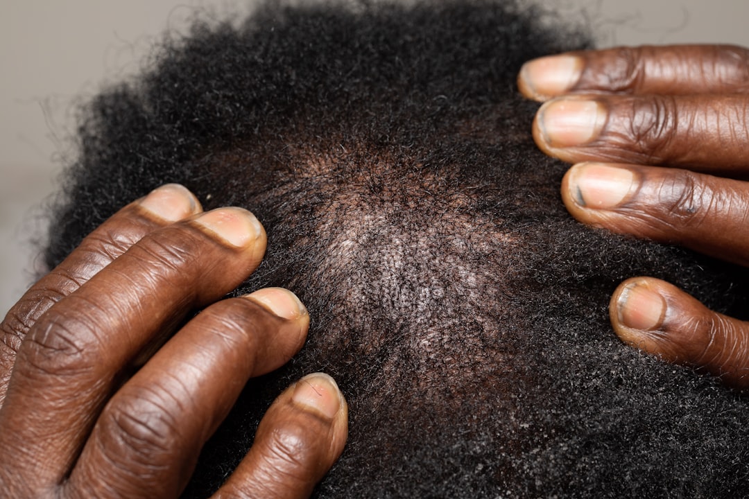 The Vibrating Brush Revolution: Why Celebrity Hairstylists Are Swapping Traditional Brushes for Scalp-Health Tech in 2026