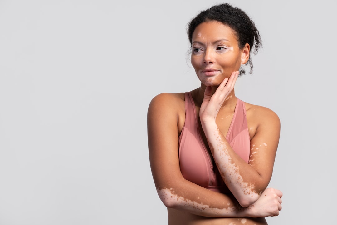 The Future of Sensitive Skin Care: How Biologic Breakthroughs Are Transforming Atopic Dermatitis Treatment